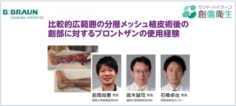 [症例報告] 福岡大学病院　前岡尚憲先生によるプロントザンの使用症例をご紹介します