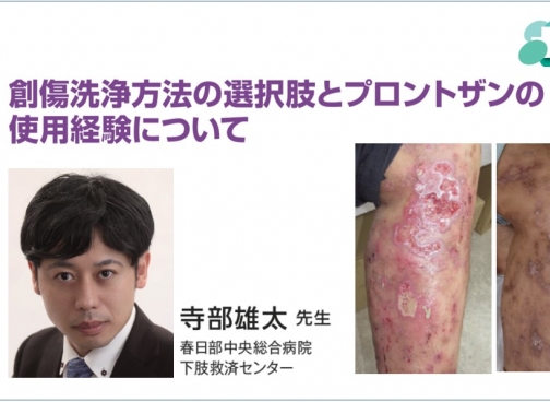 [症例報告] 春日部中央総合病院　寺部雄太先生によるプロントザンの使用症例をご紹介します